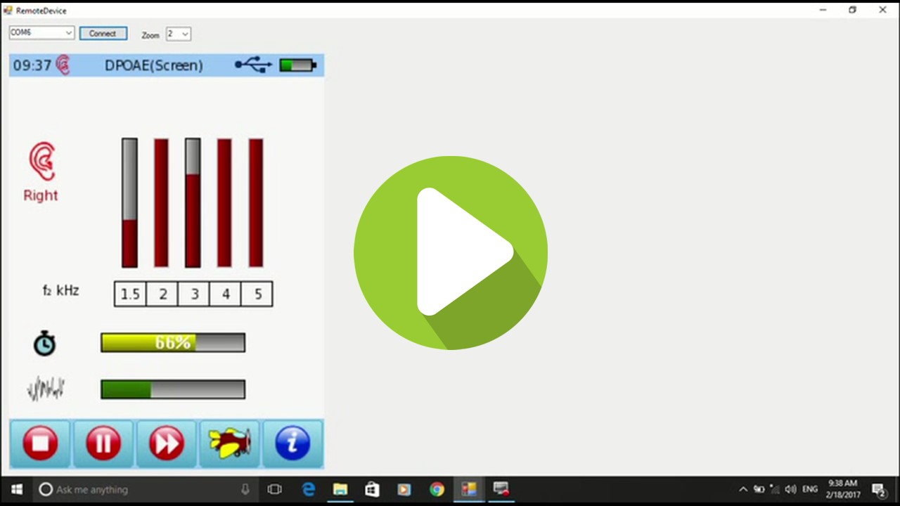 SENTIEROによるDPOAEスクリーニング